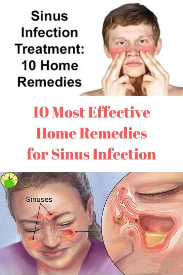 10 Most Effective Home Remedies for Sinus Infection