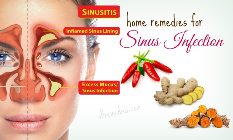 20 Best Natural Home Remedies for Sinus Infection in Adults