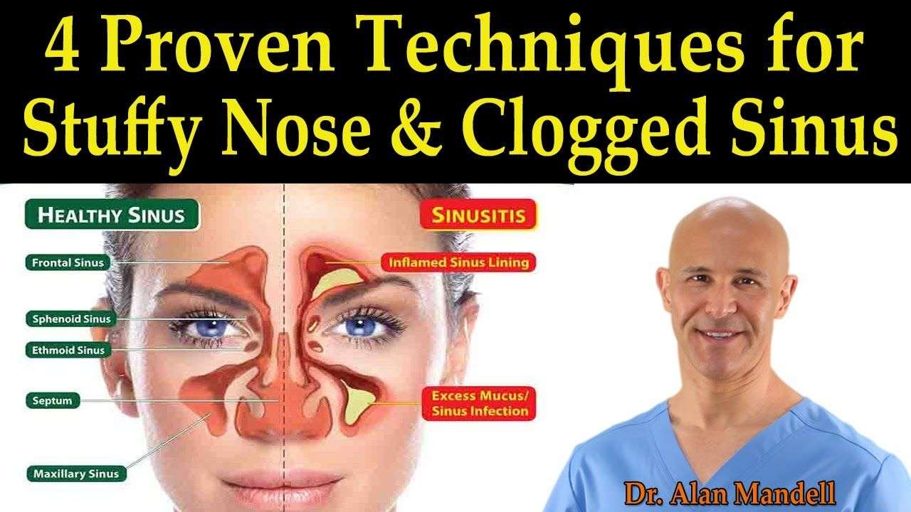 4 Proven Techniques for Stuffy Nose &  Clogged Sinus