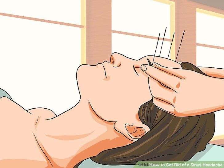 4 Ways to Get Rid of a Sinus Headache in 2021