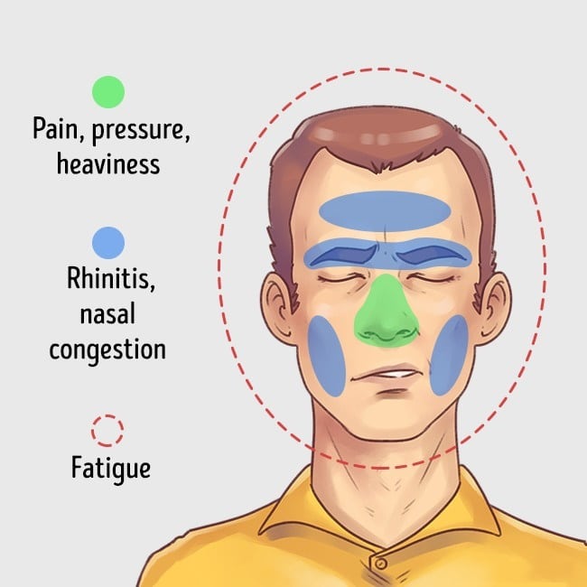 5 Types of Headaches and the Best Ways to Get Rid of Them