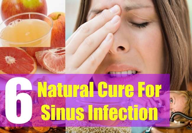 6 Natural Cure For Sinus Infection
