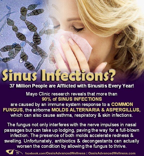 Can Mold Cause Sinus Infections