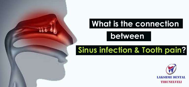 Can Sinus Drainage Cause Gum Pain