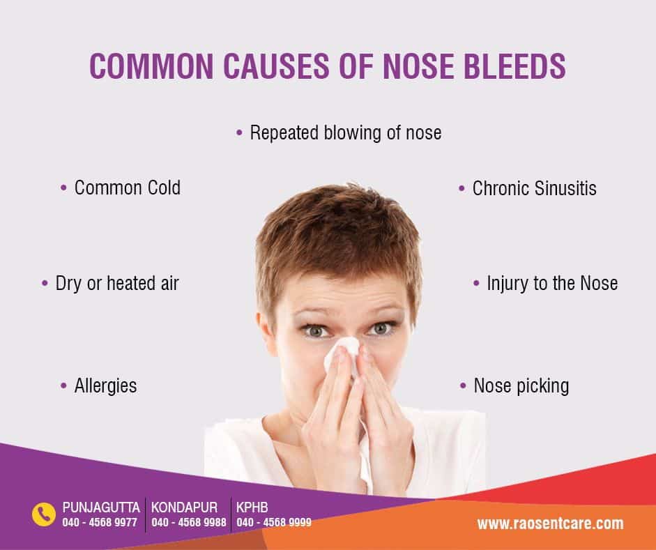 Common Causes of Nose Bleed https://raosentcare.com/bleeding