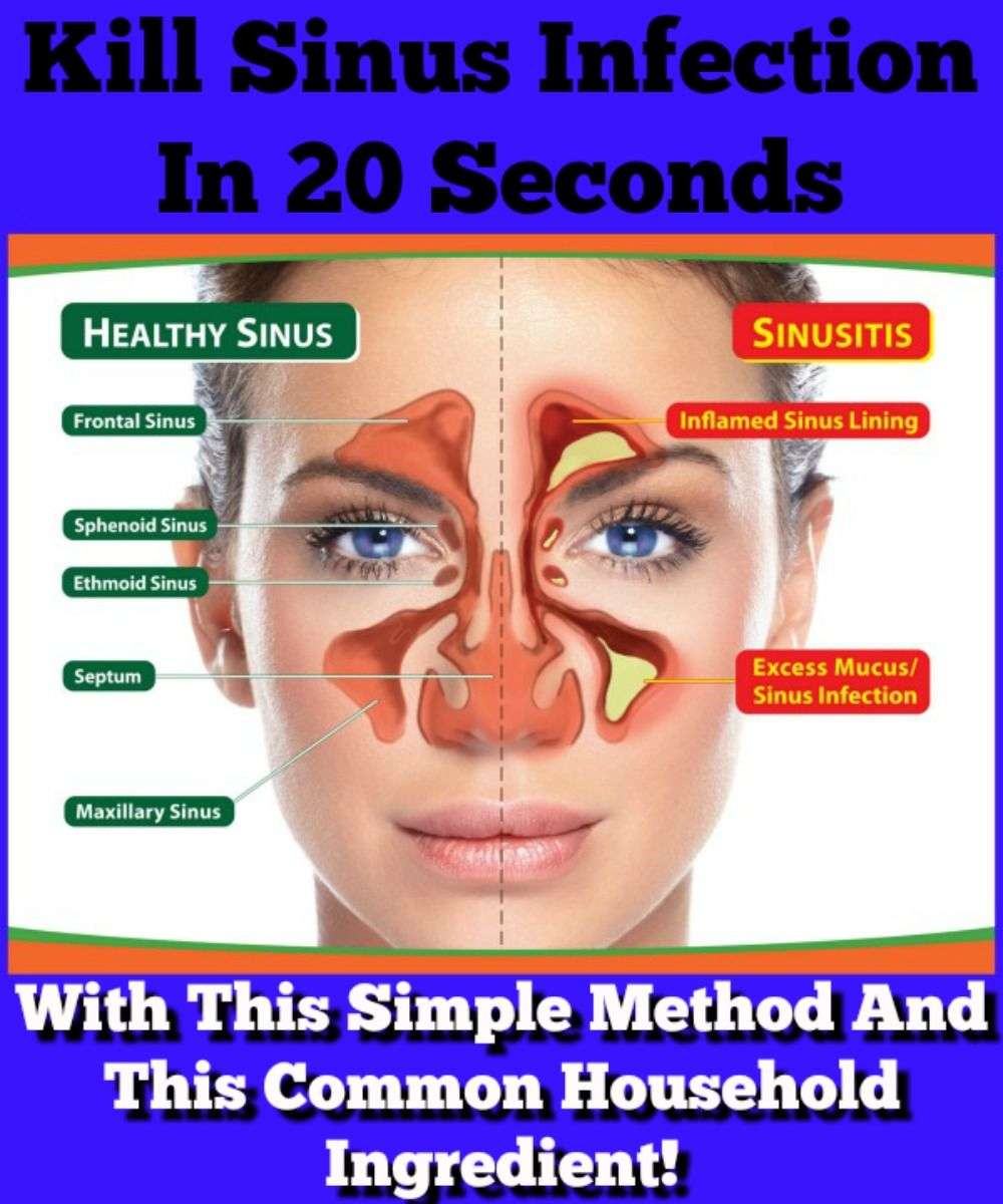 Cure Sinus Infection In A Few Seconds Using A Kitchen ...