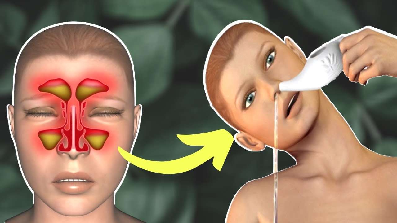 Do This To Relieve Sinus Pressure Naturally