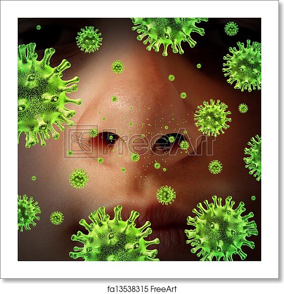 Free art print of Nasal Infection. Nasal infection as a contagious ...