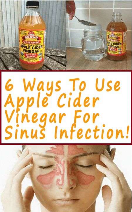 Get rid of a Sinus infection with Apple Cider Vinegar