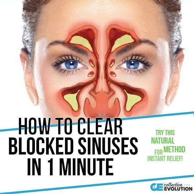 Having clogged sinuses isnt fun. You cant breath, you ...