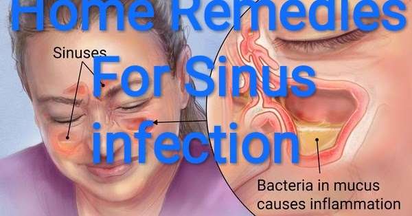 Healthcare &  Health solution: home remedies for sinus infection