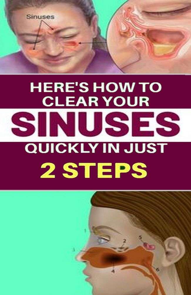 Heres How to Clear Your Sinuses Quickly In Just Two Steps