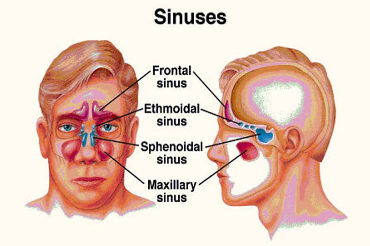 Home Remedies For Sinus Infection In Babies