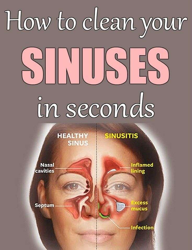 How to clean your sinuses in seconds