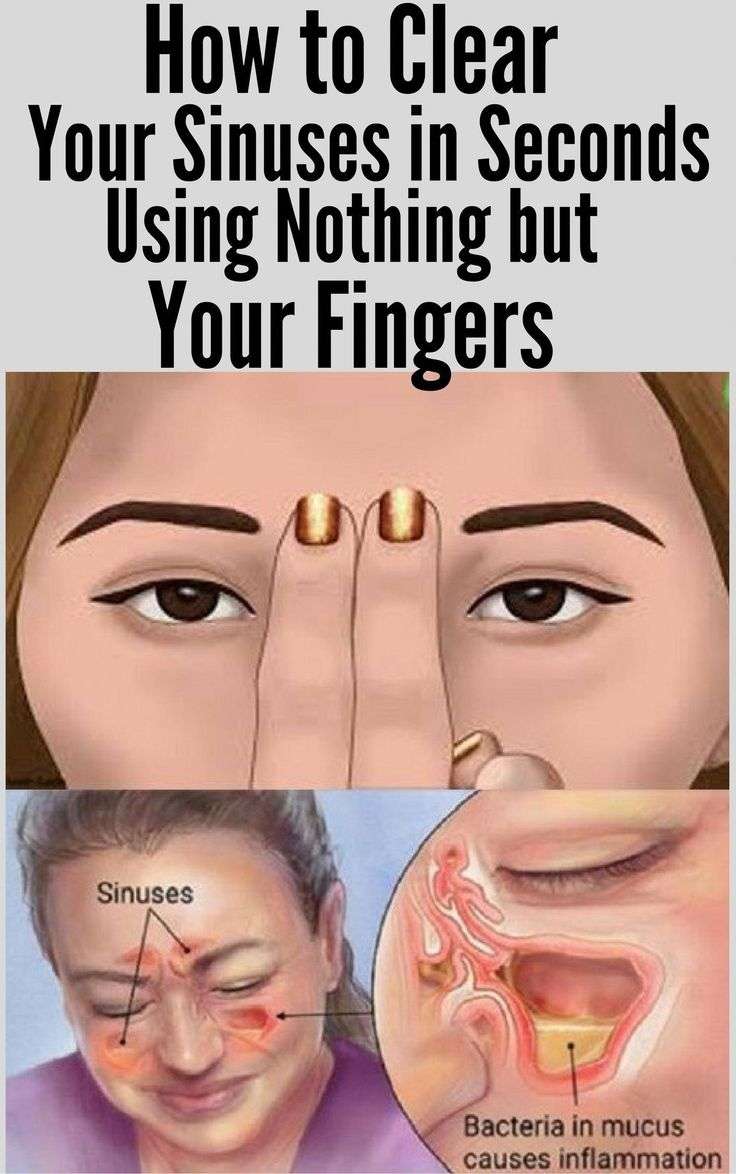 How to Clear Your Sinuses in Seconds Using Nothing but Your Fingers in ...