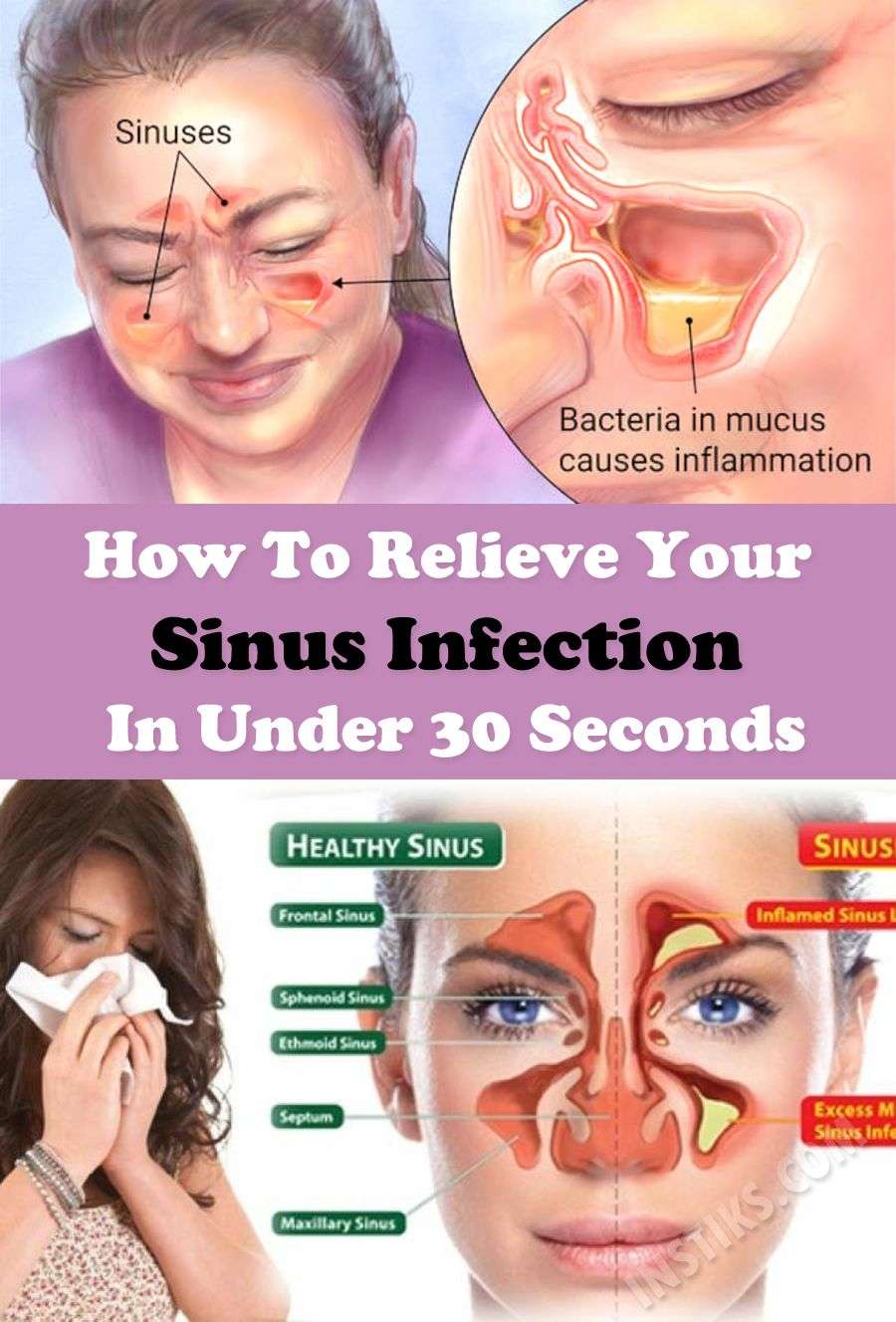 How To Get Rid Of A Sinus Headache Instantly Reddit