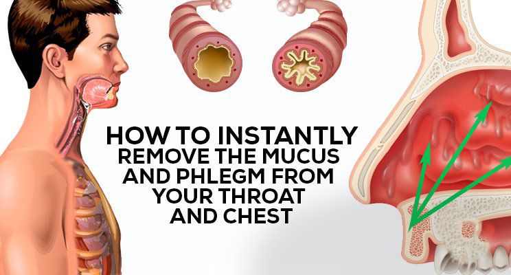 How to Get Rid of Phlegm and Mucus in Chest &  Throat