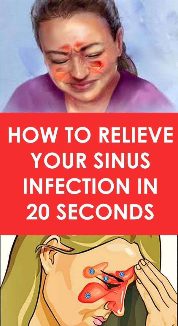 How To Relieve Your Sinus Infection In 20 Seconds