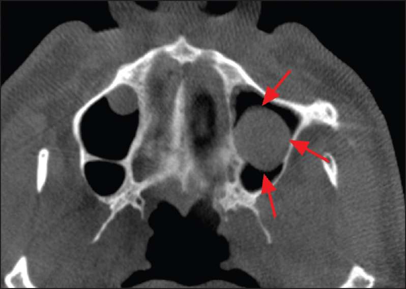 Incidental findings on cone beam computed tomography: Relate and relay ...