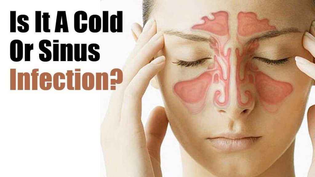 Is it sinus or common cold: Here