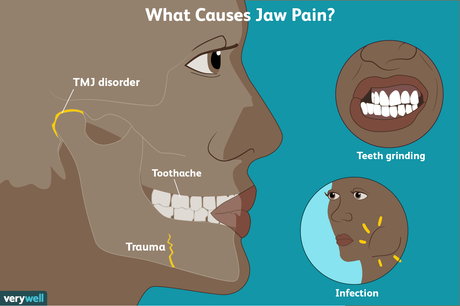 Jaw Pain Symptoms, Causes, Diagnosis, and Treatment