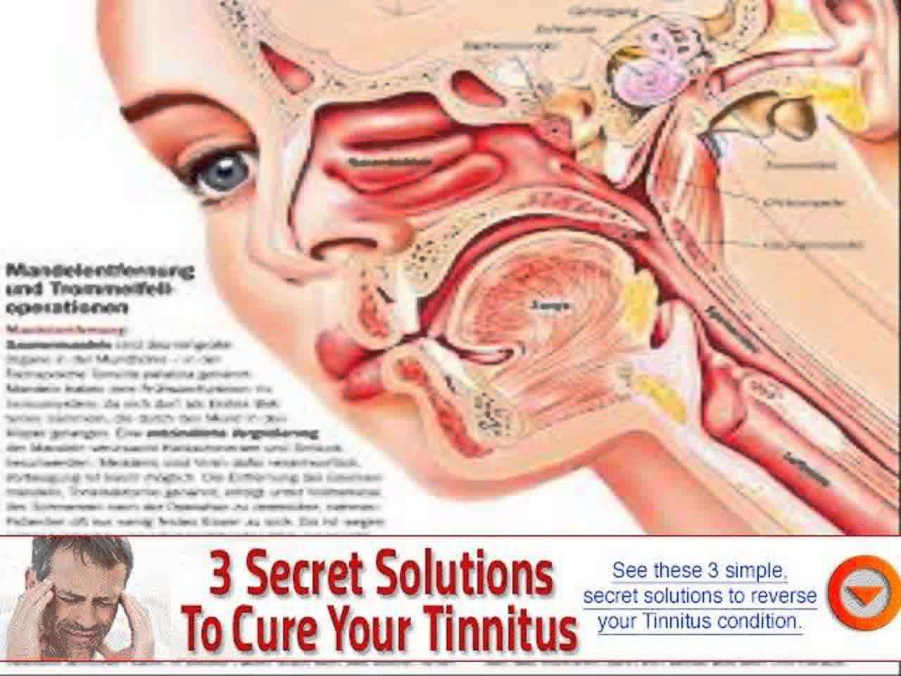managing tinnitus prompted by allergies