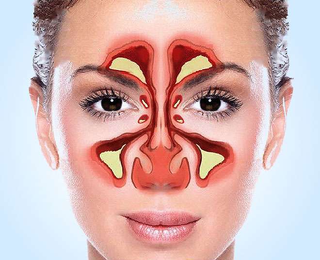Minus Sinus: Know Important Facts of Sinus to Stay Healthy