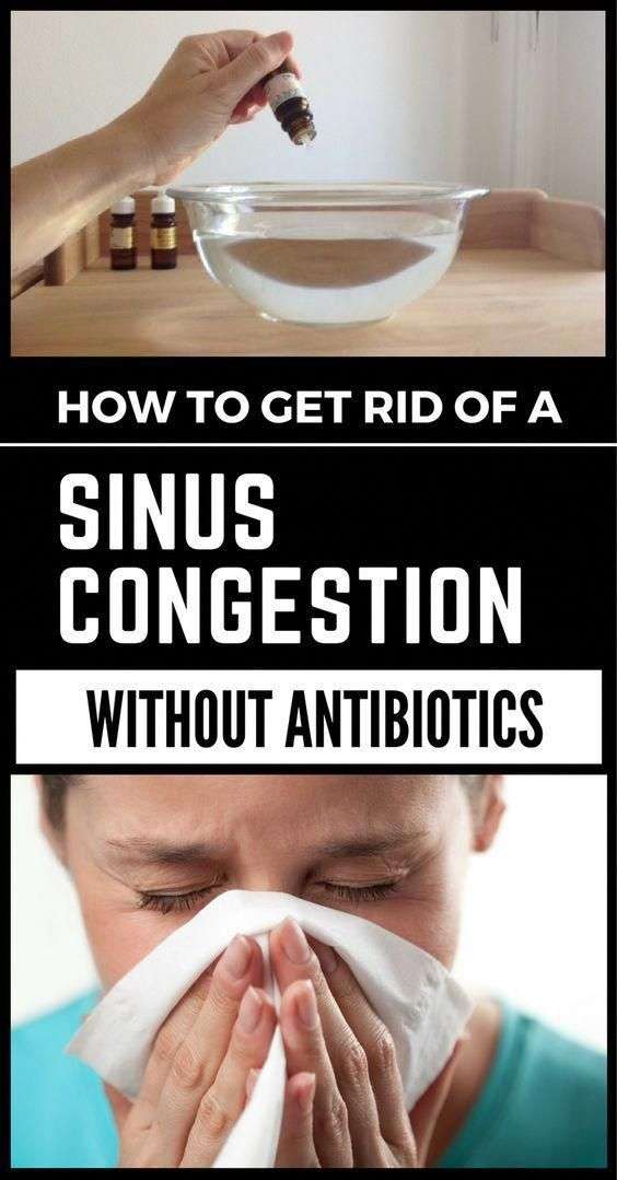 Most sinus infections are viral, not bacterial, so these ...