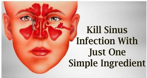 Remove Sinus Infection In 20 Seconds With A Kitchen ...