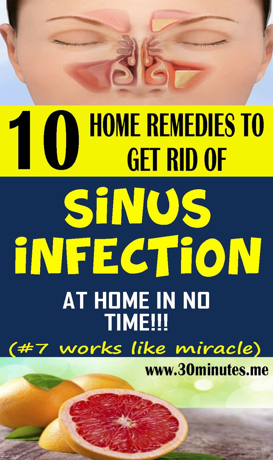 Sinus Infection Treatment: 10 Home Remedies