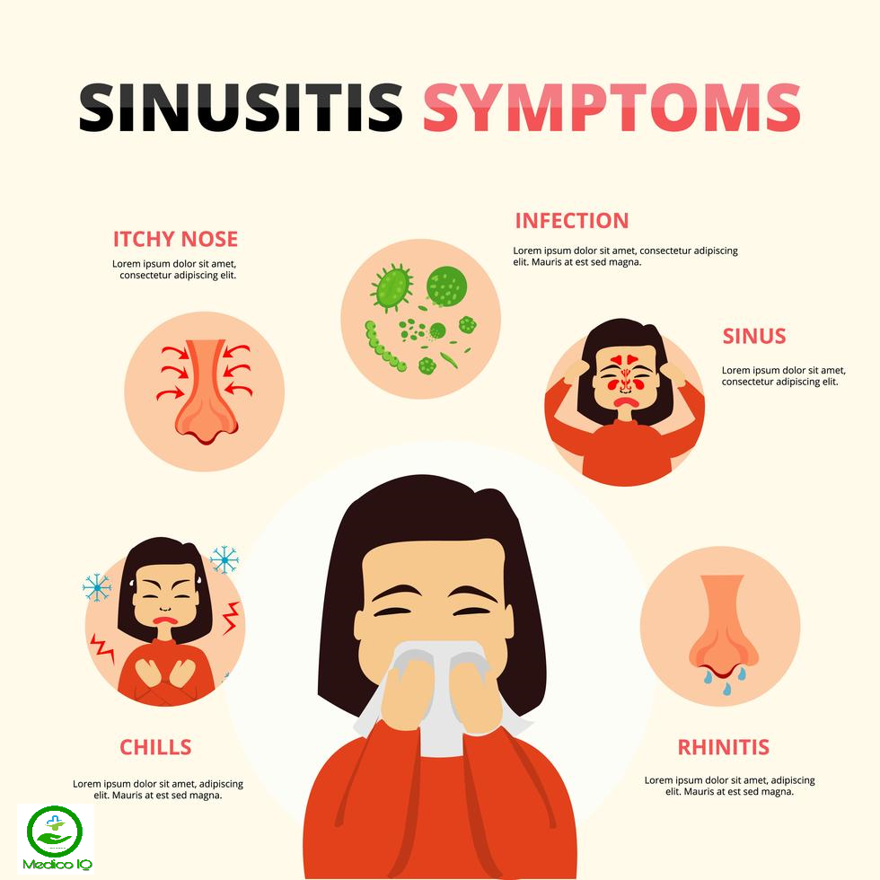 Sinusitis Causes, Symptoms &  Treatment ( Sinus Infection ...