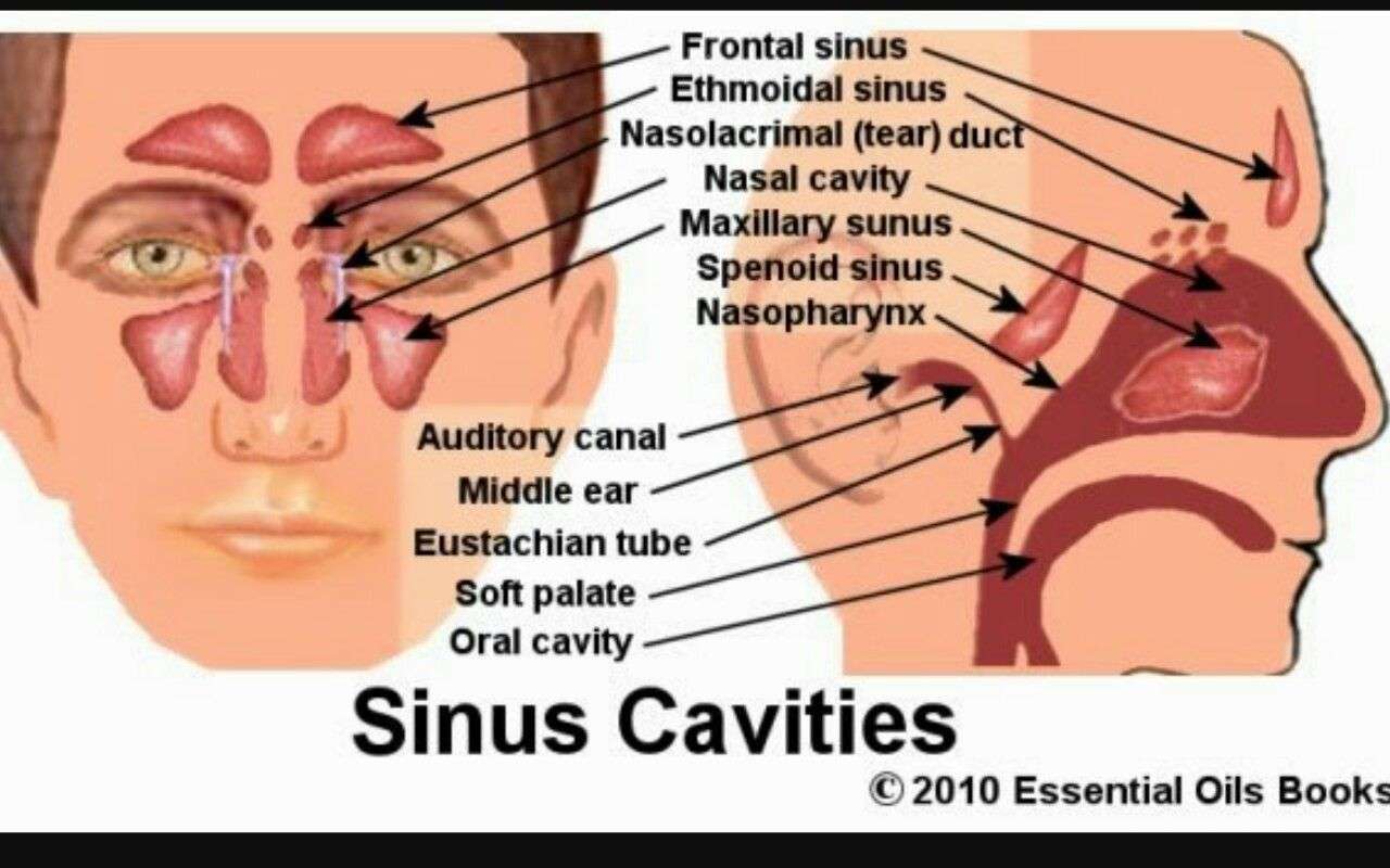 Sinusitis Infection Is It Contagious Severe Tinnitus ...