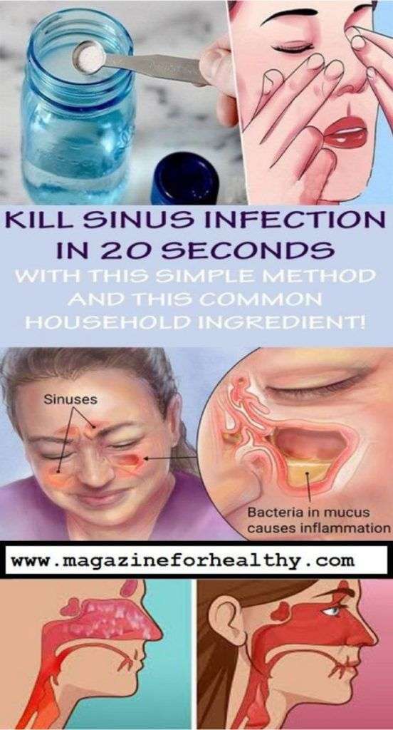Struggling with Sinus Infection? Hereâs how to quickly get ...