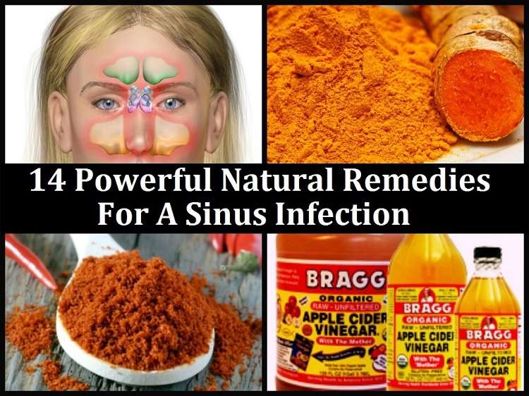 Templeton Times: 14 Powerful Natural Remedies For A Sinus ...