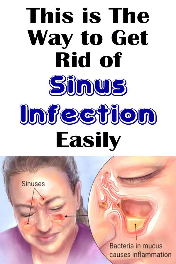 This is The Way to Get Rid of Sinus Infection Easily