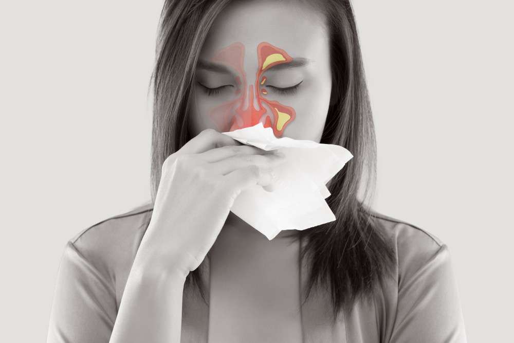 Treating Your Sinus Infection